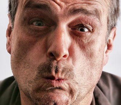 Cómo eliminar el mal aliento