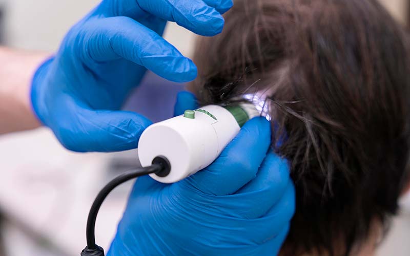 ¿Qué son las unidades foliculares?