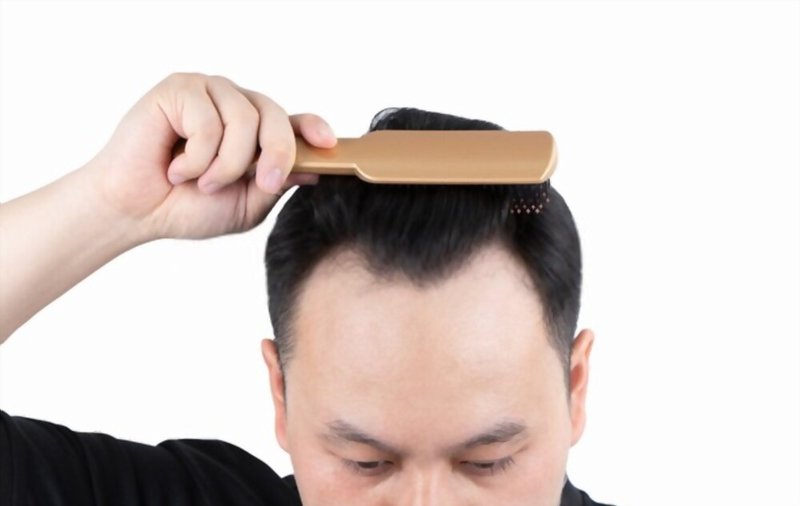 Implantes Capilares: Una Solución Eficaz para la Pérdida de Cabello